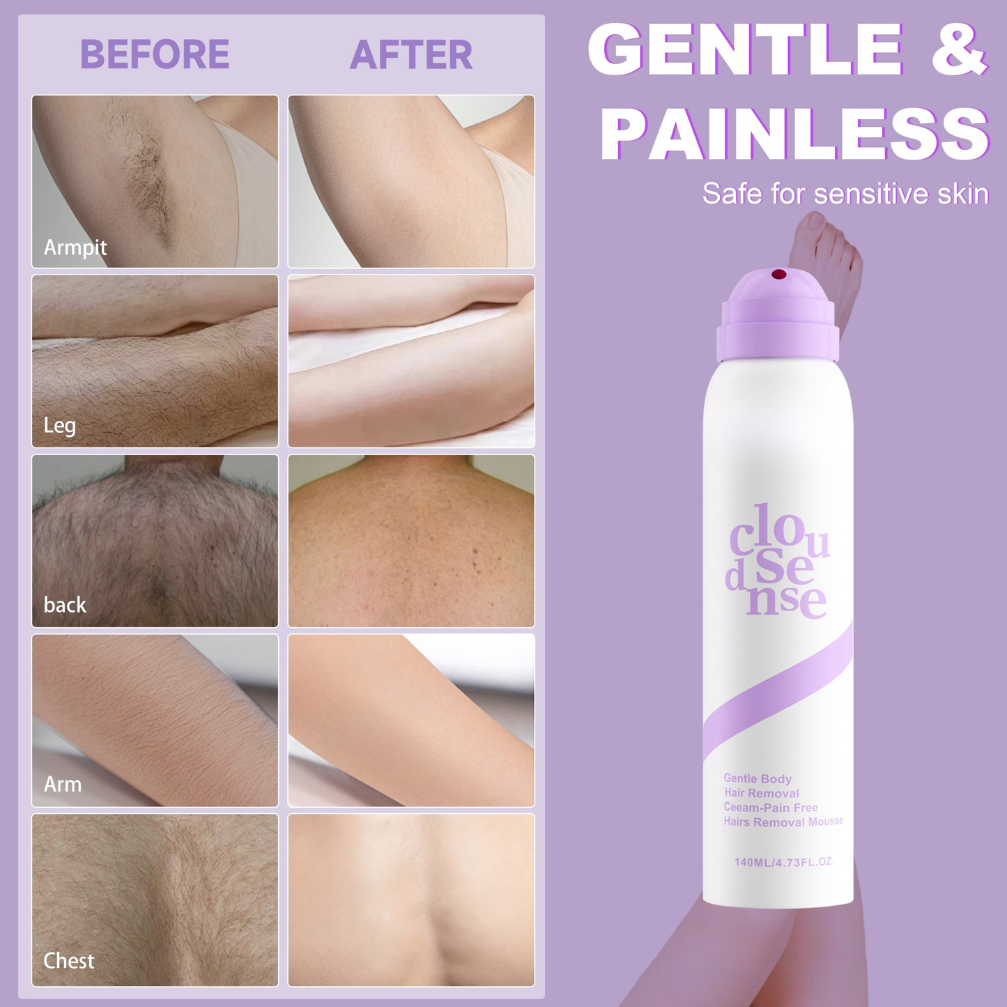 Gentle Hair Removal Mousse